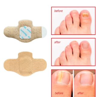 21 PCS Hydrogel Fungal Nail Care Patches – Easy-Apply Nail Care Treatment Patches, Convenient Foot & Toenail Care